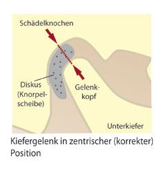 Craniomandibuläre Dysfunktion