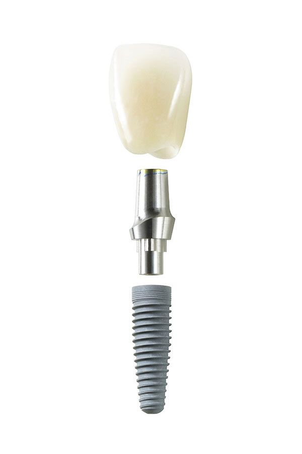 Miniimplantate